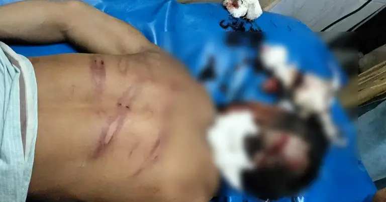 আহত ব্যবসায়ী